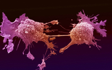 طرق «تجويع» الخلايا السرطانية