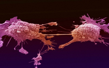 اختراع أنابيب مجهرية يمكنها كشف وتدمير الخلايا السرطانية