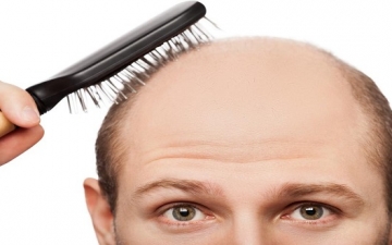 التخلص من تساقط الشعر عند الرجال