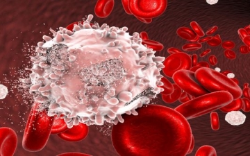 طريقة “ثورية” لعلاج سرطان الدم