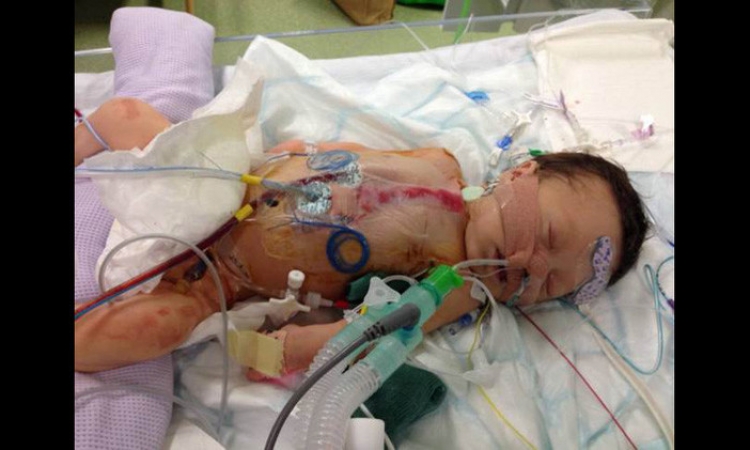 طفلة تجرى أول عملية جراحية لها بعد 3 ساعات من الولادة