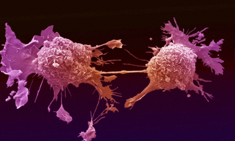 طرق «تجويع» الخلايا السرطانية