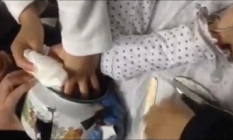 بالفيديو .. إنقاذ طفلة علق رأسها داخل إبريق شاي
