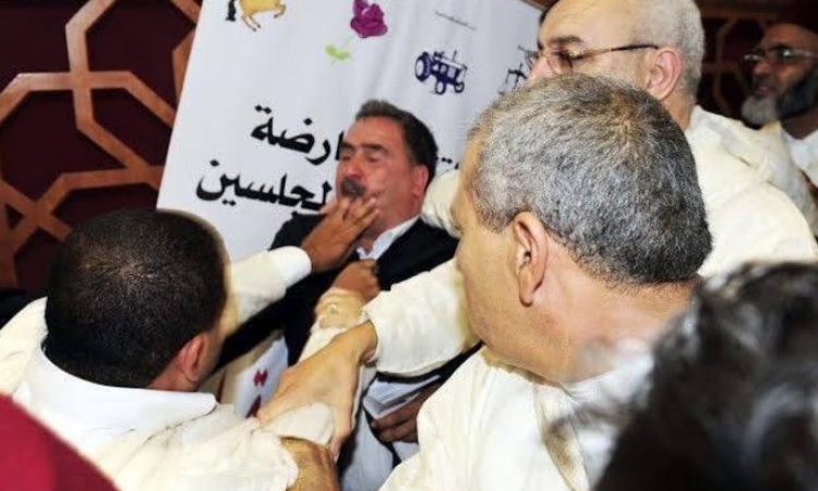 بالصور.. برلماني مغربي يعض إصبع زميله تحت قبة المجلس