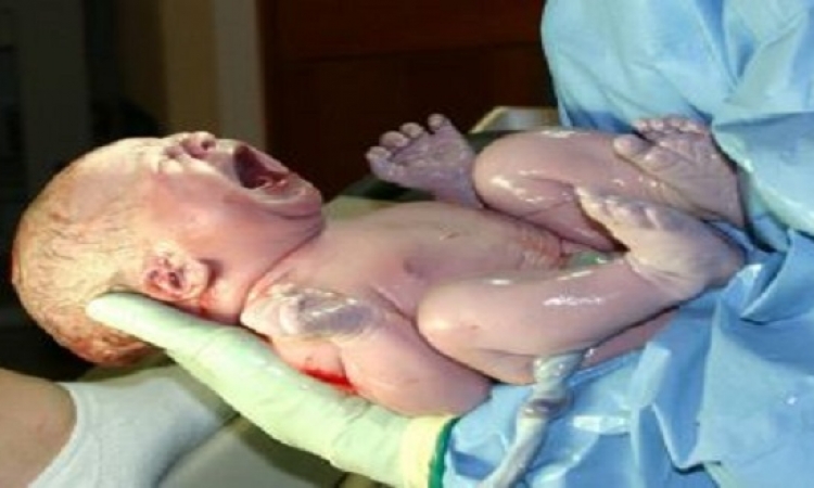 ولادة طفل بعد زراعة مبيض .. عملية ناجحة من المرة الأولى