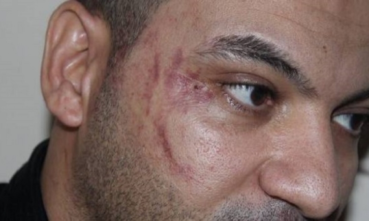 القبض على أشقاء النائب المتهم بالاعتداء على عامل مصرى بالأردن
