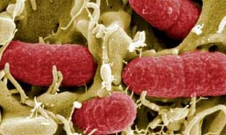 البكتريا المعوية “إى كولاى” تتفشى فى 9 ولايات أمريكية