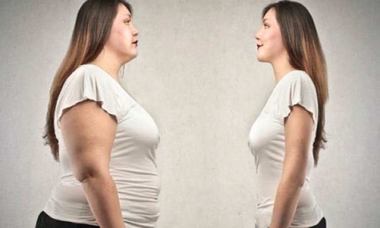 جراحات إنقاص الوزن قد تزيد مخاطر الاصابة بالكسور