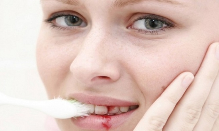 ماذا يدل نزيف اللثة المتكرر أثناء تنظيف الأسنان؟!