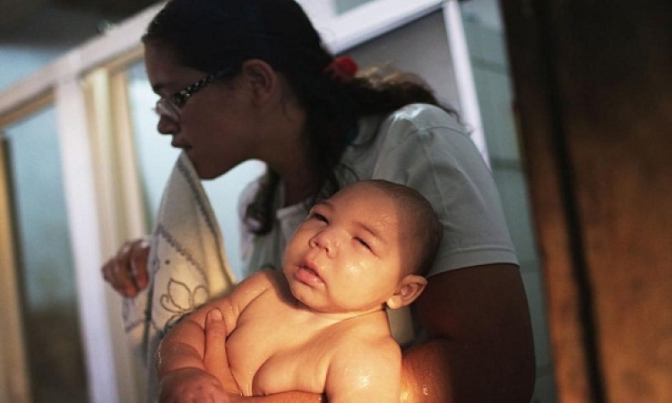 3 ألاف حامل أصبن بعدوى فيروس زيكا فى كولومبيا