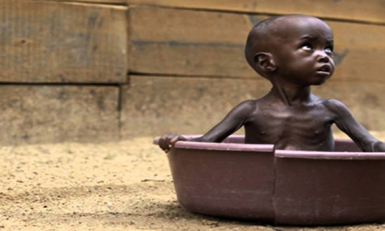 أكثر من 113 مليون إنسان يعانون من الجوع الحاد